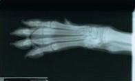 x-ray